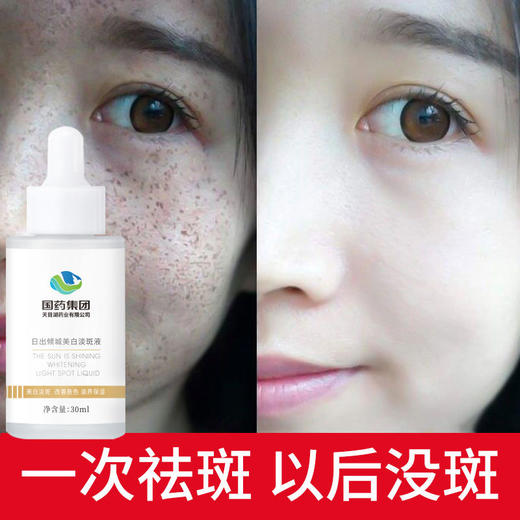 【买2送1，买3送2】淡斑焕白小白瓶  国药集团出品，提亮肤色，消斑去黑，补水保湿 商品图1