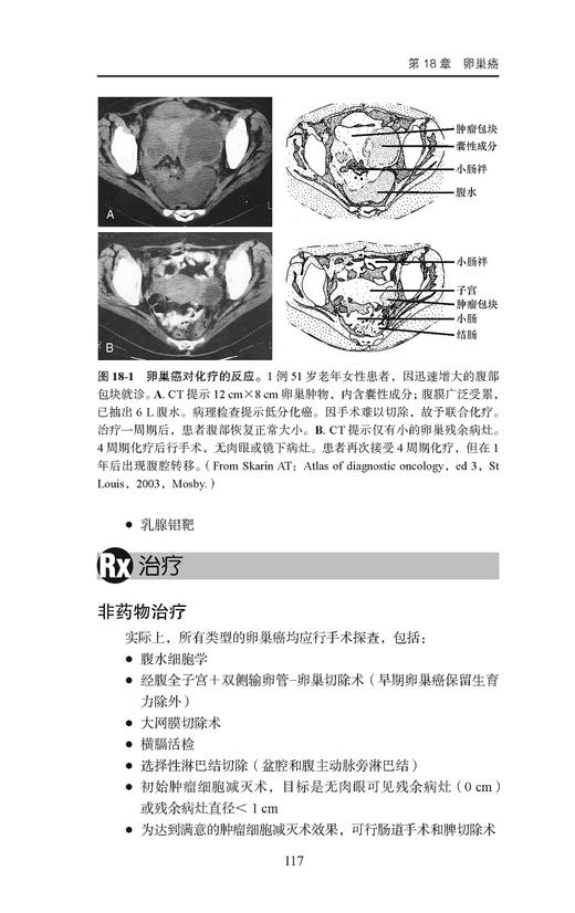 Ferri临床诊疗指南 妇产科疾病诊疗速查手册 弗雷德费里 著 住院医师专科医师参考书籍妇产科学 北京大学医学出版社9787565924217 商品图4