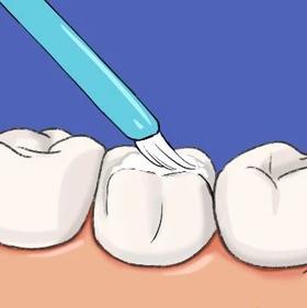 孩子明明每天都刷牙为什么还是总蛀牙？护牙这件事90%的家长都做错了！