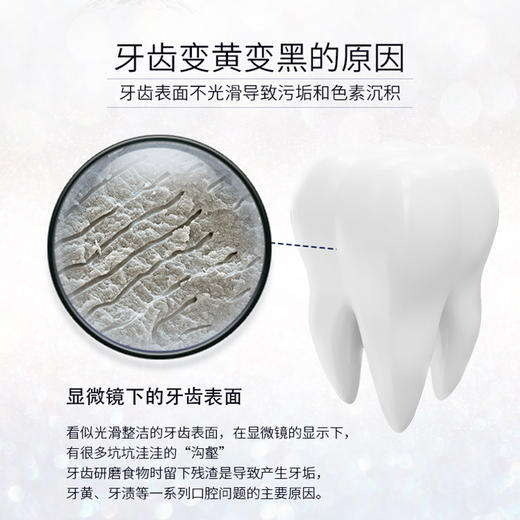 【有点贵但真的有用!】瑞士Dr,wild怀尔德抛光去渍牙膏 针对牙垢牙黄 一周用2次/去渍立竿见影/瑞士精工不伤牙 商品图6