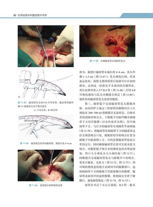 实用泌尿外科腹腔镜手术学 张骞 李学松 主编 外科学书籍 腹腔镜检应用泌尿系统外科手术 北京大学医学出版社9787565923333 商品图4