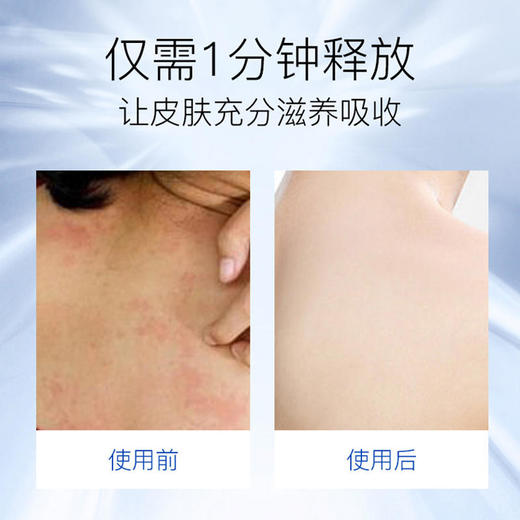 【国庆不打烊】【买2送1】中美联合研发MVO湿疹膏成人热痒皮肤瘙痒皮炎无ji素医用冷敷理疗止痒凝胶 商品图3