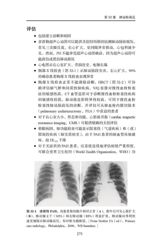 Ferri临床诊疗指南 呼吸系统疾病诊疗速查手册 弗雷德费里 著 医学生住院医师专科医师参考书 北京大学医学出版社9787565924620 商品图4