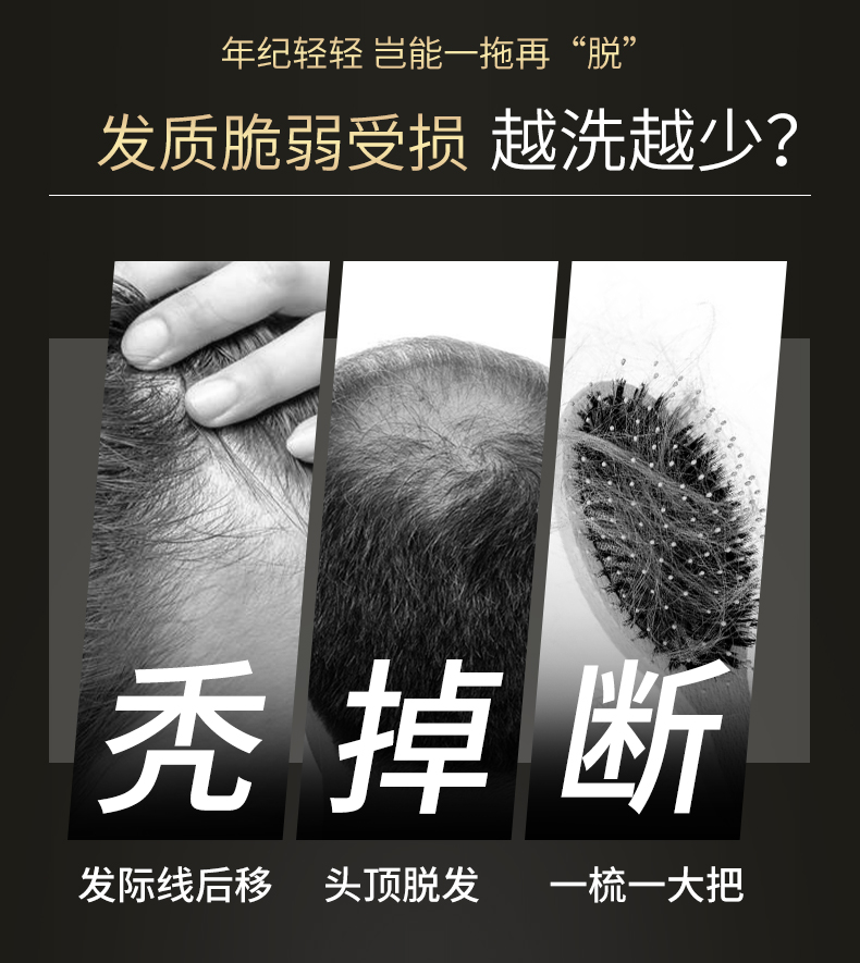 防脱发选修正修正防脱育发洗发水长发控油去屑止痒防脱发让秀发自然