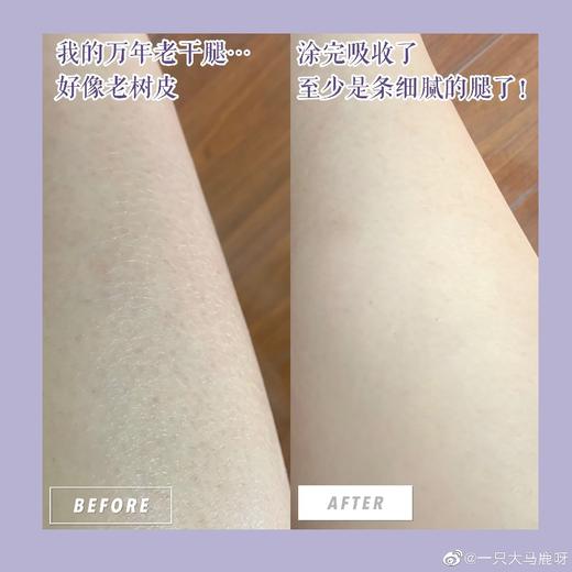 必入宝藏油！德国freiol福来身体美白精华油125ml（27.5.30） 商品图5