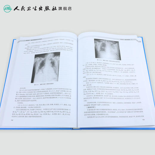 重症肺病名医学术经验传承与实践 商品图4