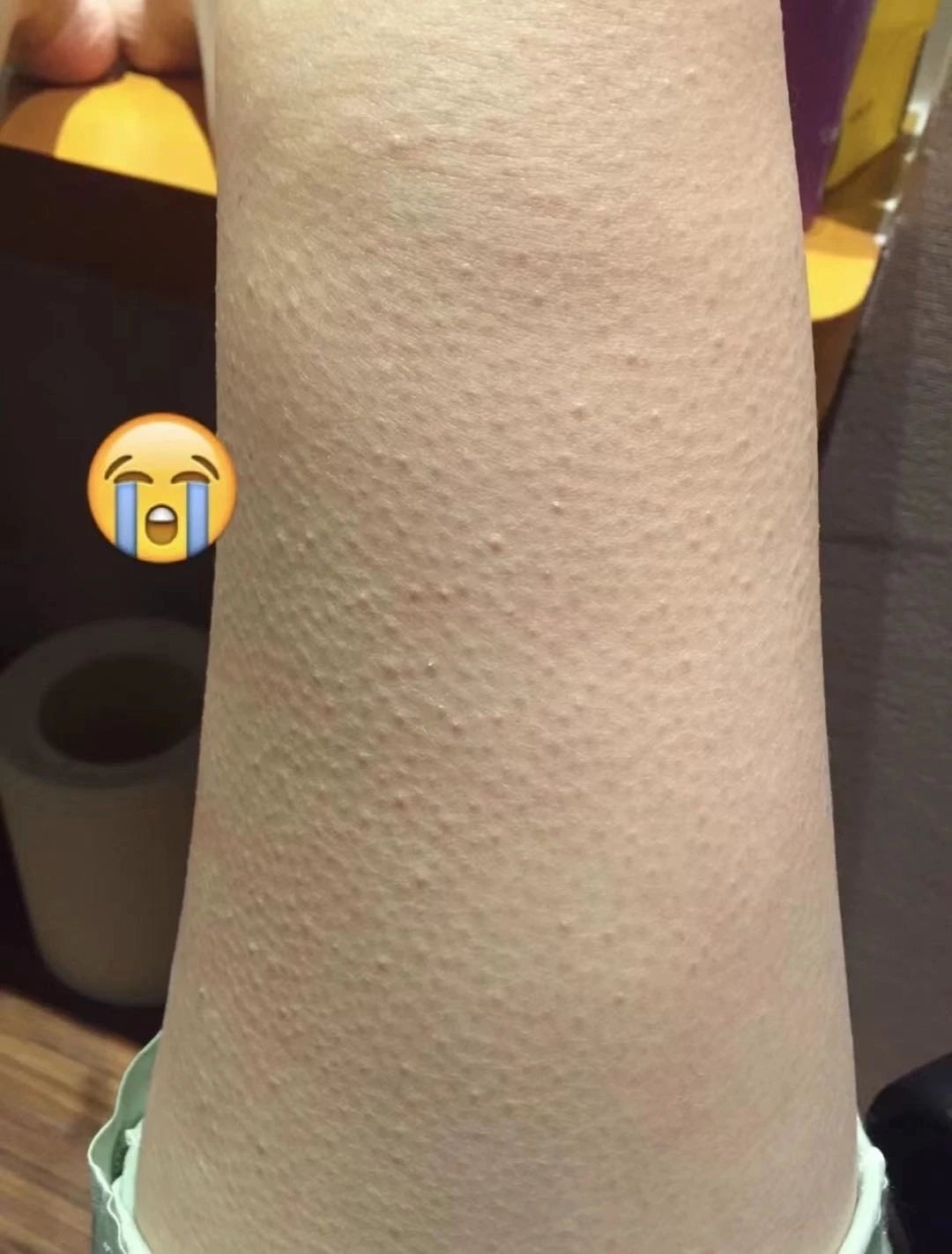 【1瓶/2瓶】spes复合多酸角质软化霜120ml/瓶~添加了5种植物酸,能快速