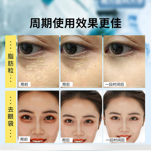 【第2瓶半价】南方医科大学视黄醇焕颜清润精华液眼部颗粒克星植物萃取0ji素0酒精 商品图2