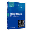 癫痫磁共振成像 翻译版 姚一 张建国 梁树立 陈 蕾 主译 医学影像学影像诊断系列 9787117246972 放射医学 2017年7月参考书 商品缩略图0