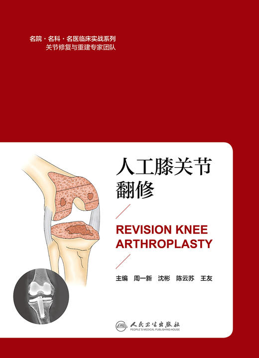 [旗舰店 现货]人工膝关节翻修 周一新 沈彬 陈云苏 王友 主编 9787117271035 外科学 2018年7月参考书 人卫 商品图1