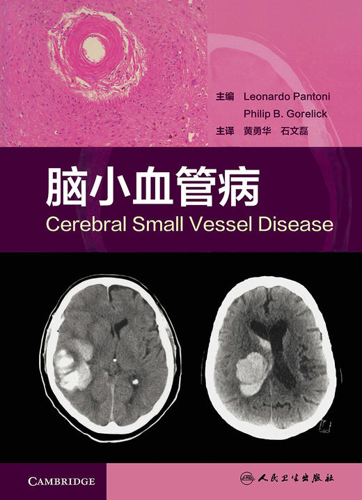 [旗舰店 现货]脑小血管病 黄勇华 石文磊 主译 内科学 9787117269964 2018年7月参考书 人民卫生出版社 商品图1