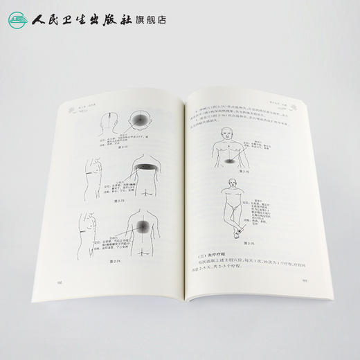 [旗舰店 现货]热敏灸实用读本（第2版）陈日新、陈明人、康明非 著 针灸推拿 9787117289689 2019年10月参考书 人民卫生出版社 商品图4