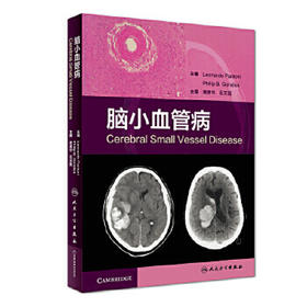 [旗舰店 现货]脑小血管病 黄勇华 石文磊 主译 内科学 9787117269964 2018年7月参考书 人民卫生出版社