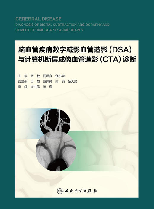 脑血管疾病数字减影血管造影（DSA）与计算机断层成像血管造影（CTA）诊断 商品图1