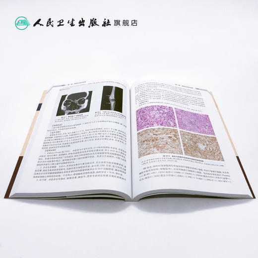 神经系统疑难病案解析第2辑 戚晓昆黄旭升张金涛主编 2020年9月参考书 商品图4