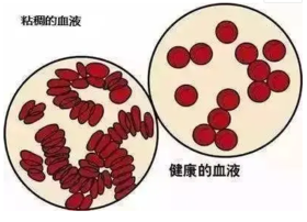 5个信号通知你“血液黏稠”！用好这些血液“稀释剂”，血液流畅、预防血栓 