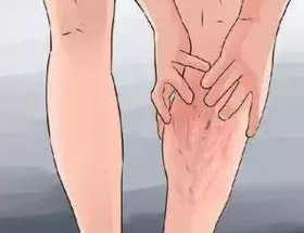 “心梗”“脑梗”您知道，“腿梗”您听说过吗？ 