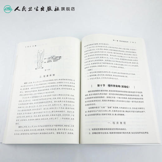 热敏常灸出奇效 慢病康复新选择 2020年11月参考书 人民卫生出版社 商品图4