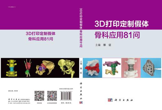 3D打印定制假体骨科应用81问/郭征 商品图3