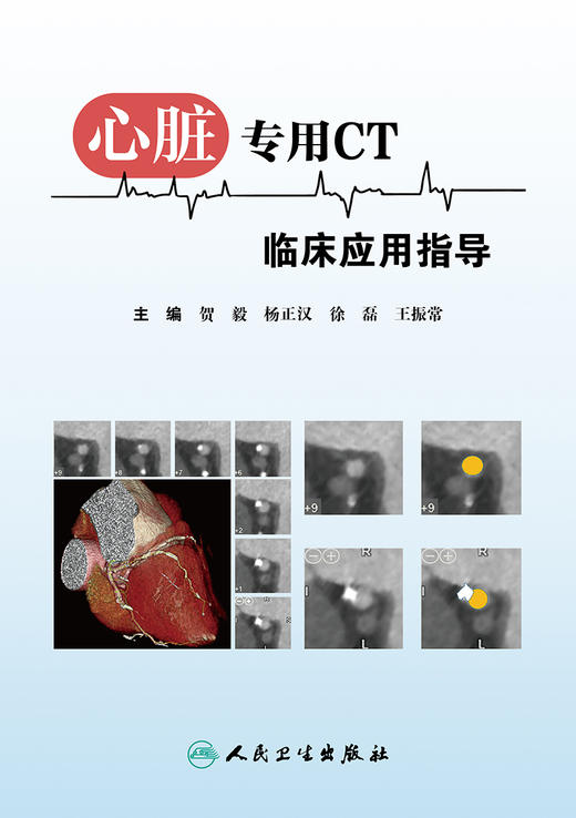 心脏专用CT临床应用指导 贺毅杨正汉徐磊王振常主编 2020年8月参考书 商品图1