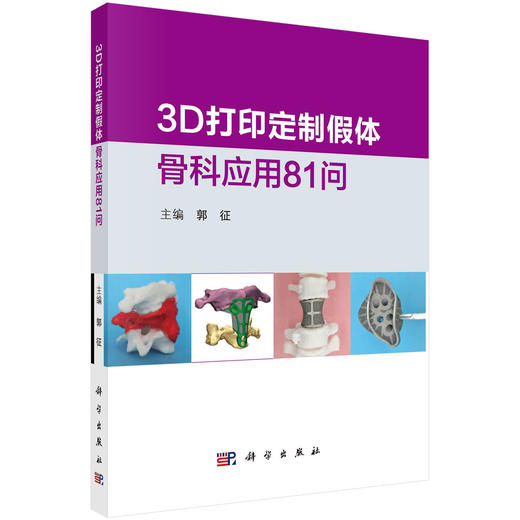 3D打印定制假体骨科应用81问/郭征 商品图0