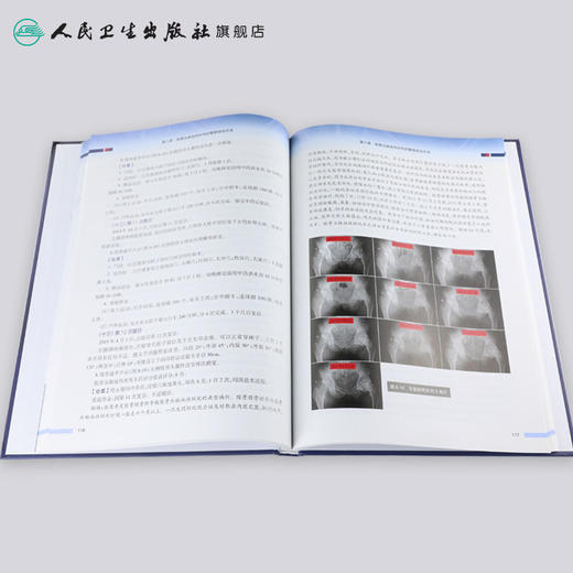[旗舰店 现货]股骨头缺血性坏死整体综合疗法 车兆勤 主编 9787117268110 骨伤科学 2018年6月参考书 人民卫生出版社 商品图4