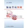脑血管病图解 9787117140041 临床医生必读 商品缩略图1