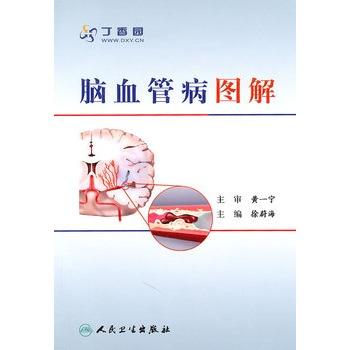 脑血管病图解 9787117140041 临床医生必读 商品图1