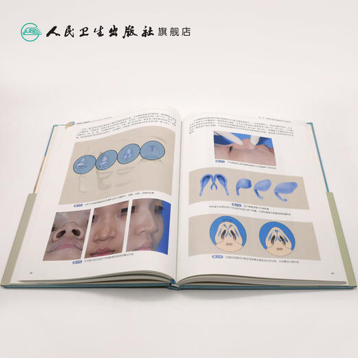 [旗舰店 现货] 鼻整形应用解剖学 牛永敢 孔晓 王阳 斯楼斌 主编 外科学 9787117281706 2019年3月参考书 人民卫生出版社 商品图4