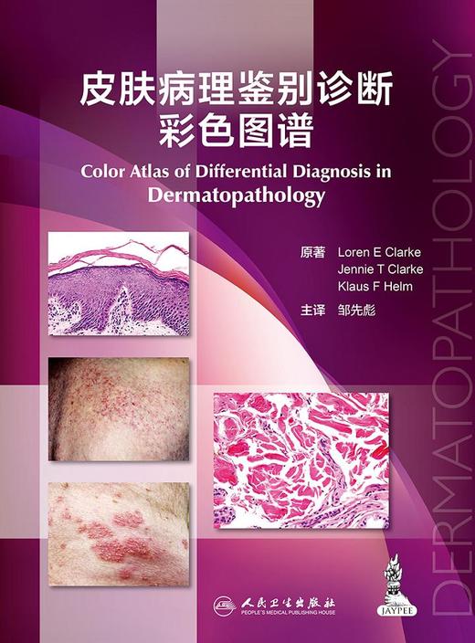 皮肤病理鉴别诊断彩色图谱(翻译版)  邹先彪  主译    9787117232210  2016年11月参考书 人民卫生出版社 商品图1