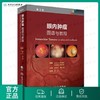 [旗舰店 现货] 眼内肿瘤:图谱与教程 李芸 主译 眼科学 9787117267229 2018年7月参考书 人民卫生出版社 商品缩略图0