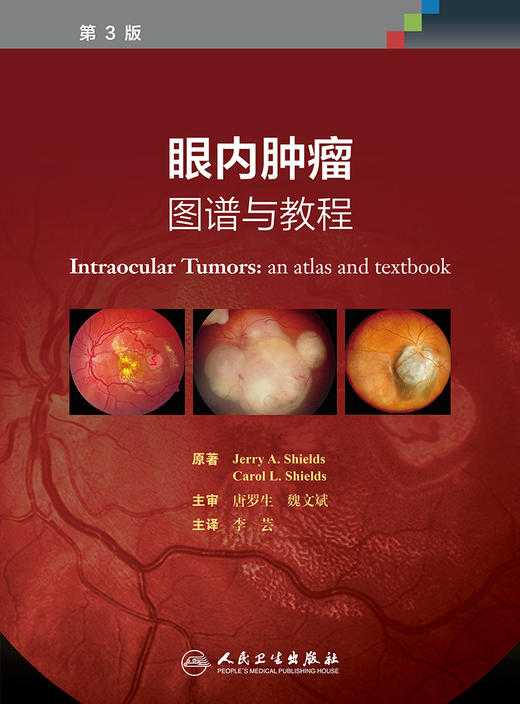 [旗舰店 现货] 眼内肿瘤:图谱与教程 李芸 主译 眼科学 9787117267229 2018年7月参考书 人民卫生出版社 商品图1