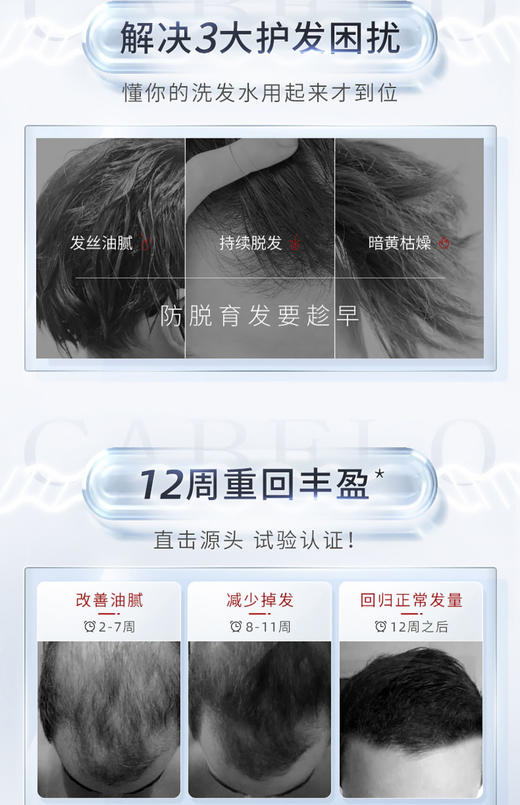 卡蓓诺 防脱洗发水/护发素（男士专用）350ml 商品图8