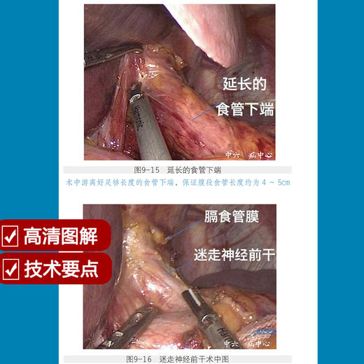 腹腔镜操作技能基础 商品图3