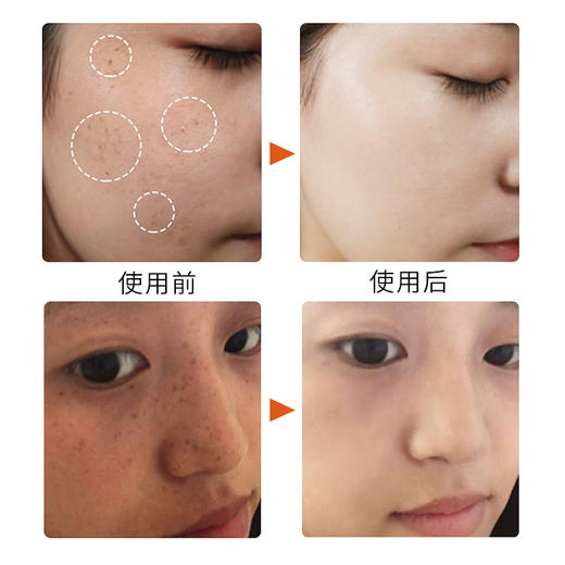 【远离黄褐斑】祛斑亮肤霜  祛斑修护提亮肤色  黑斑雀斑老年斑黄褐斑晒斑  淡斑霜淡斑精华液30g/盒 商品图5