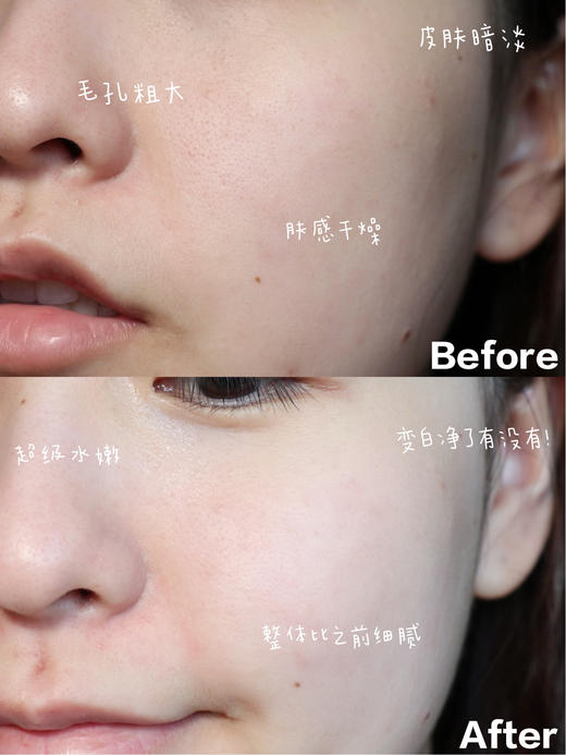 专柜509 十全大补 | 菲洛嘉美白补水保湿紧致收缩毛孔十全大补面膜50ml 商品图3