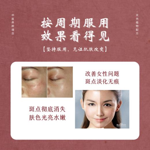 (国食健字）怡雪颗粒  根源祛班（3盒） 商品图4