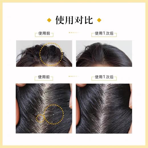 Leonor Greyl 法国LG蜂胶精华洗发露 头皮去屑止痒洗发水 商品图1