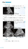 实用超声规范化检查与操作 王辉 王小丛 编 超声波诊断超声医学书籍 超声诊断报告书写范例 科学技术文献出版社9787518980284 商品缩略图4