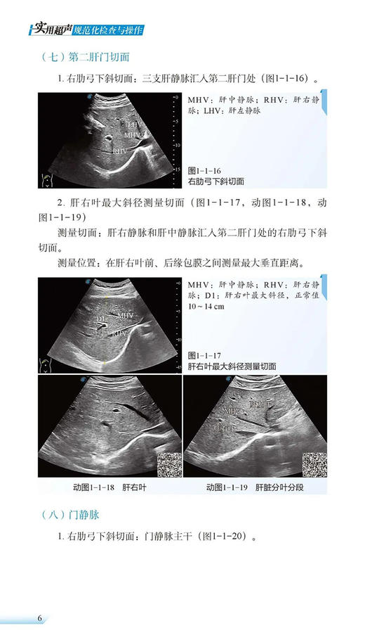 实用超声规范化检查与操作 王辉 王小丛 编 超声波诊断超声医学书籍 超声诊断报告书写范例 科学技术文献出版社9787518980284 商品图4