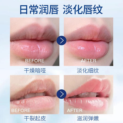 【干唇救星！凡士林润唇膏】一抹立显“果汁唇”，Nicor滋养润唇膏唇膜，补水滋润、死皮淡唇纹、去角质护理、口红打底滋润服帖。 商品图2