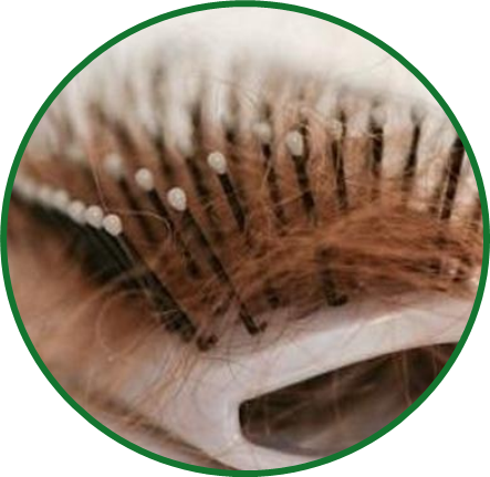 脱发.png 脱发.png