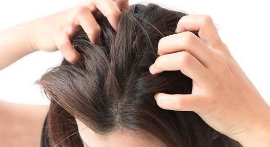 头皮瘙痒.jpg 头皮瘙痒.jpg