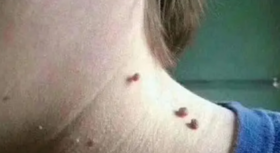 为什么淋巴会长小楸楸,你知道吗? 