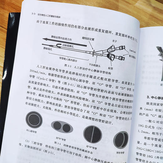 非生物型人工肝基础与临床 谢能文 熊墨龙 临床医学 肝脏医学书籍 肝脏临床手术护理专科护用书 非生物型人工肝相关 商品图3