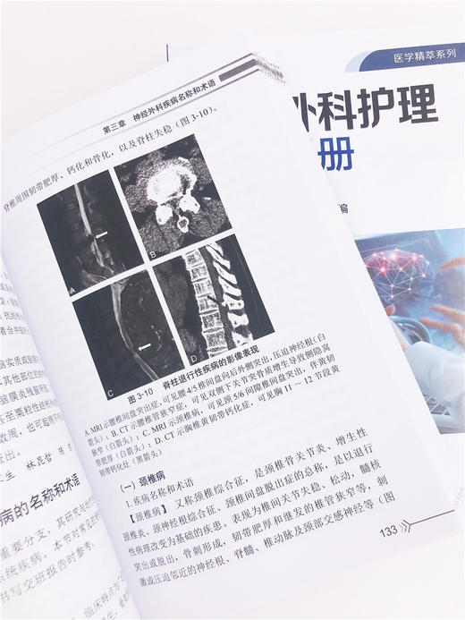 神经外科护理交班手册 神经外科护理 神经外科护士护理交班流程与规范 神经外科护士培训教材 专科护士参考书 护理实习生辅导书 商品图3