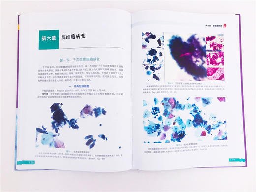 医学精萃系列 子宫颈与子宫细胞病理学诊断图谱 子宫颈细胞病理学相关基础知识 子宫颈细胞病理学进展 解剖学组织学细胞病理学书籍 商品图3