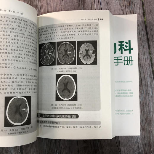神经内科专科护理+神经内科医师查房手册 2册 神经内科专科护理应用书籍 神经内科疾病诊疗指南 护理 实用神经内科学医嘱速查手册 商品图2