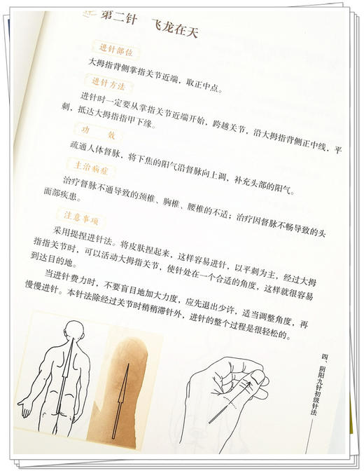 阴阳九针针法集 余浩 主编 道门针法 针灸方解书籍 阴阳九针技巧进阶与案例精选 中医学 中国中医药出版社9787513272193 商品图4