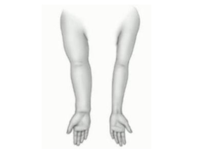  专家 | 凌泓教授：一文读懂乳腺癌淋巴结清扫的前因后果 